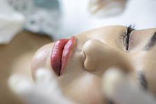 Microneedling Cost in Blauvelt, NY